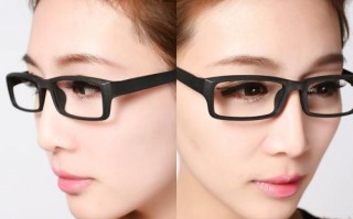 眼镜架变形了怎么办，眼镜架变形了怎么办？